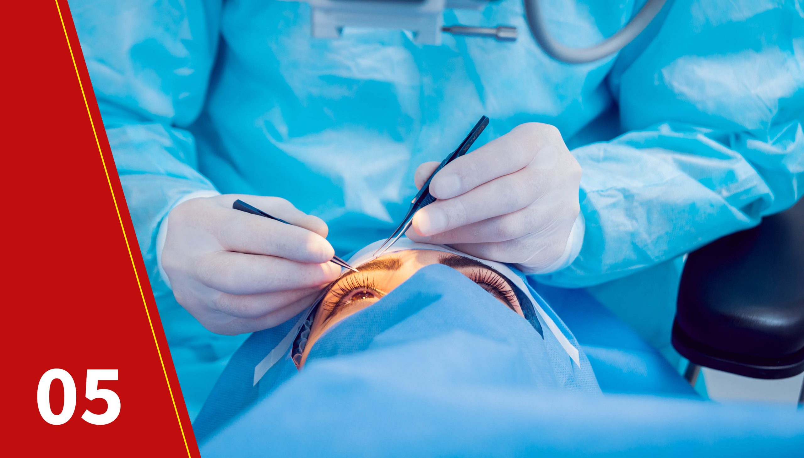 Boost your knowledge on glaucoma